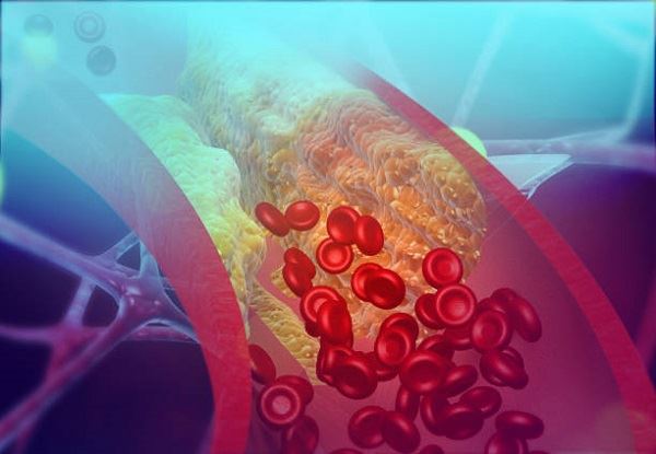 Cholesterol