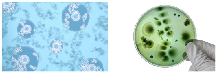 Bacteria under the microscope Bacteria under the microscope