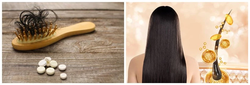 hair loss problem hair loss problem