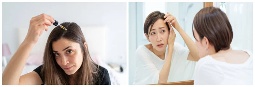 hair loss problem hair loss problem